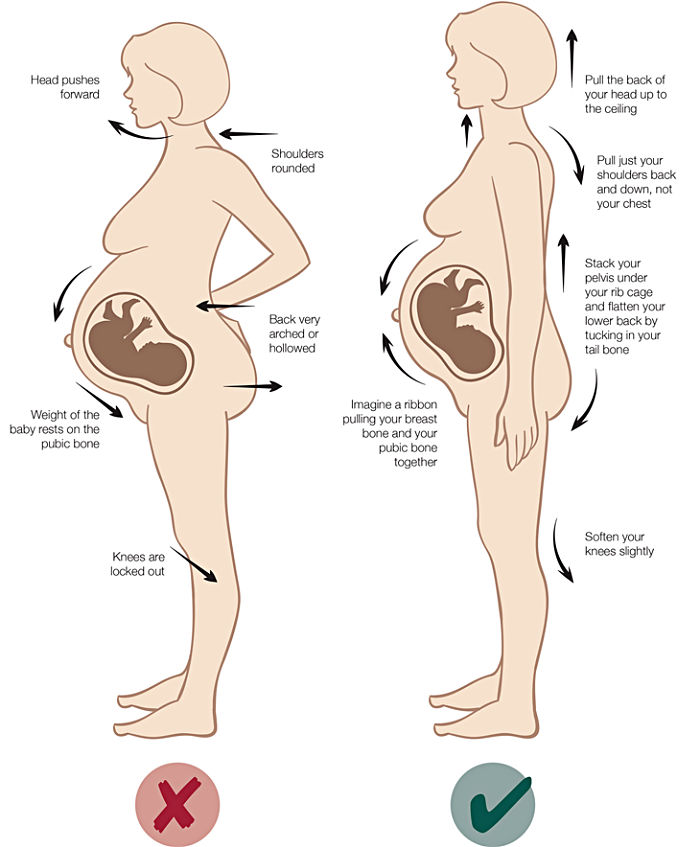 임신중 허리통증 올바른 자세, 산모 허리 통증, 임산부의 허리, 임신 중 허리 통증, 임신중 허리디스크