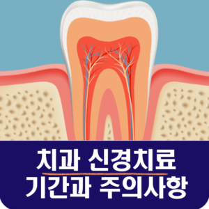 치과 신경치료 기간과 주의사항 과정