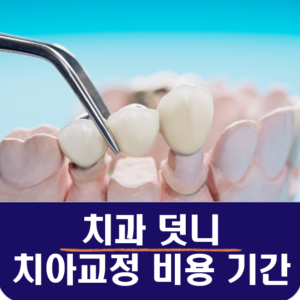 치과 덧니,치아교정 비용 기간 : 교정 하지마라?